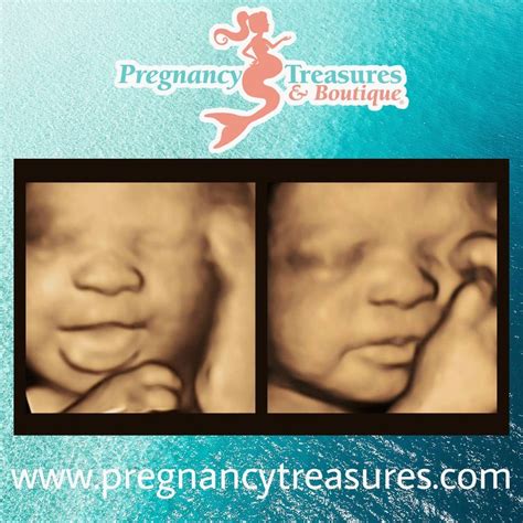 pregnancy treasures